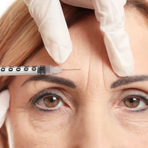 Botox by Dr. Yogesh, vampire facelift