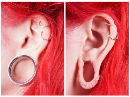 ear lobe repair need