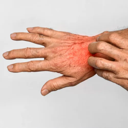 Fungal infections
