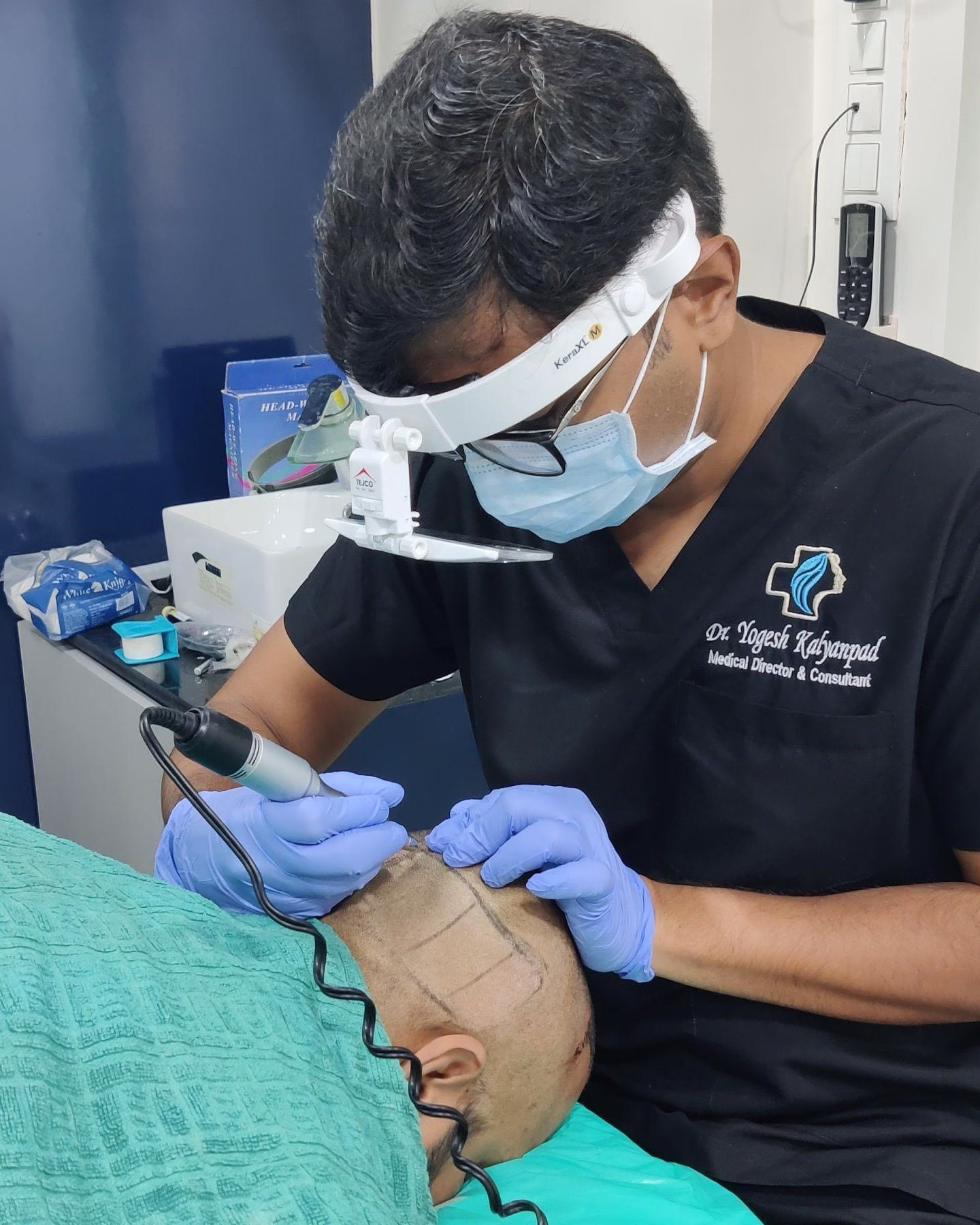 hair transplant
