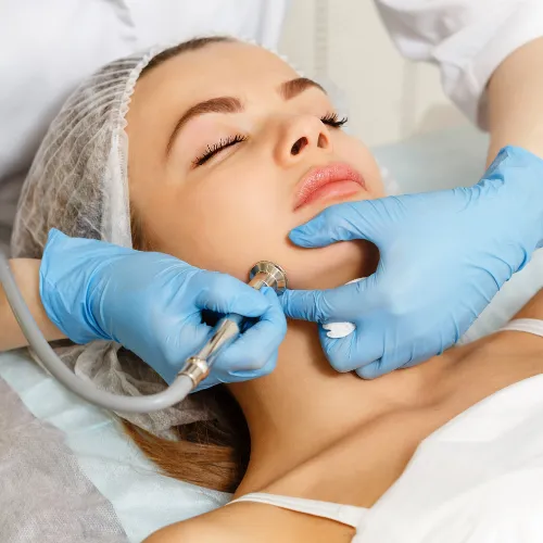 Microdermabrasion by Dr. Yogesh