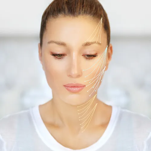 Thread lift